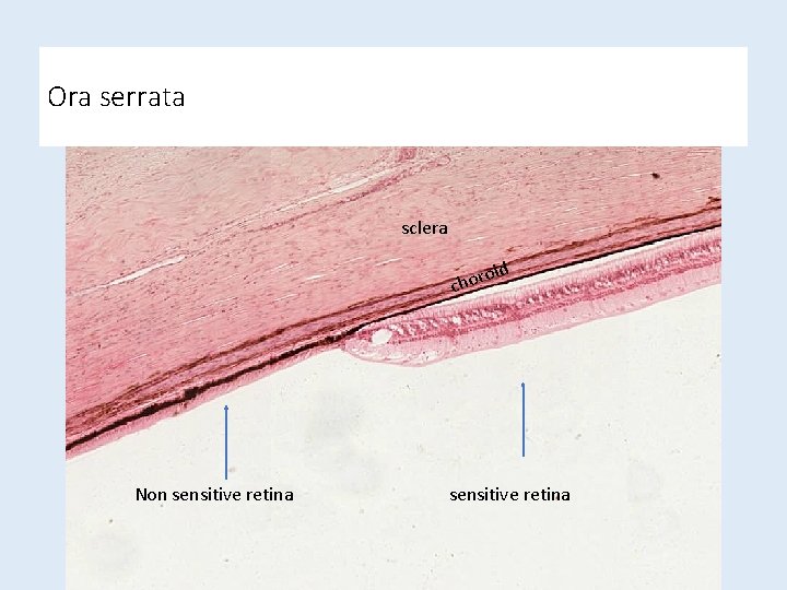 Ora serrata sclera d oi chor Non sensitive retina Ora serrata sclera d oi chor Non sensitive retina