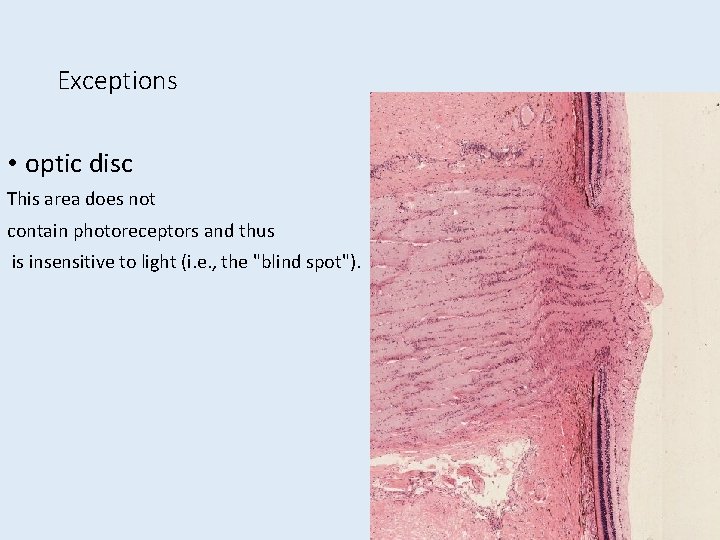 Exceptions • optic disc This area does not contain photoreceptors and thus is insensitive Exceptions • optic disc This area does not contain photoreceptors and thus is insensitive