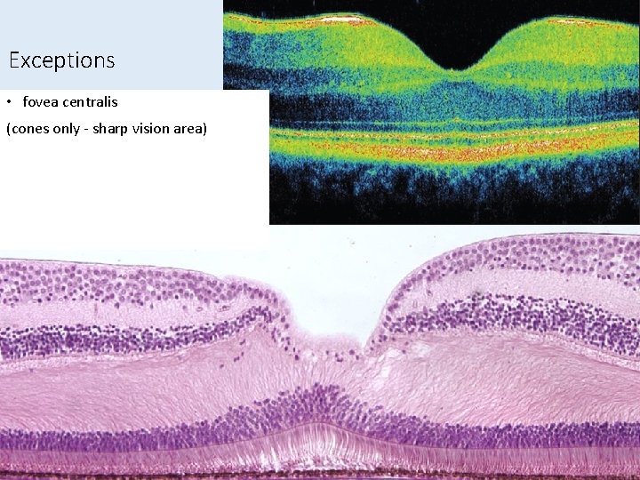 Exceptions • fovea centralis (cones only - sharp vision area) Exceptions • fovea centralis (cones only - sharp vision area)