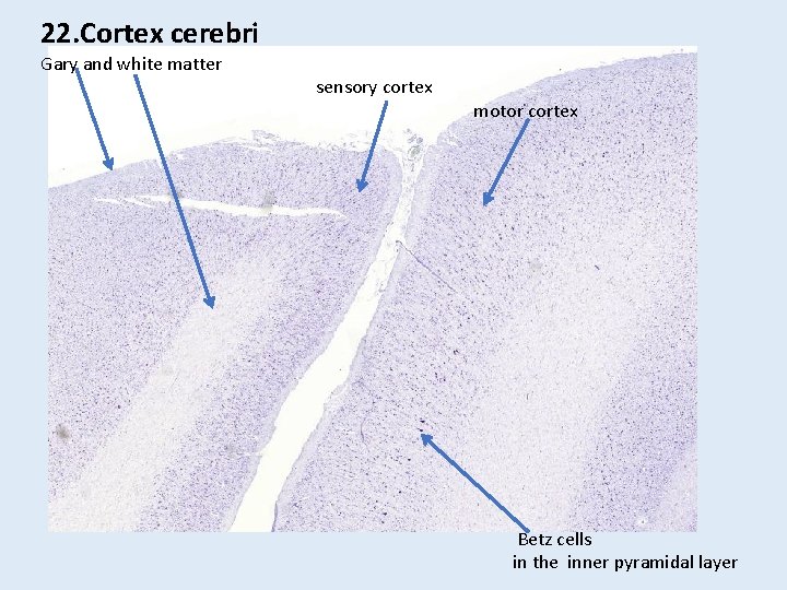 22. Cortex cerebri Gary and white matter sensory cortex motor cortex Betz cells in 22. Cortex cerebri Gary and white matter sensory cortex motor cortex Betz cells in