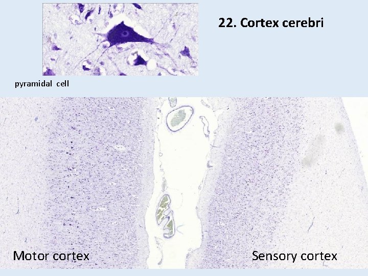22. Cortex cerebri pyramidal cell Motor cortex Sensory cortex 22. Cortex cerebri pyramidal cell Motor cortex Sensory cortex