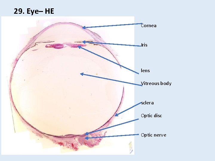 29. Eye– HE Cornea Iris lens Vitreous body sclera Optic disc Optic nerve 29. Eye– HE Cornea Iris lens Vitreous body sclera Optic disc Optic nerve