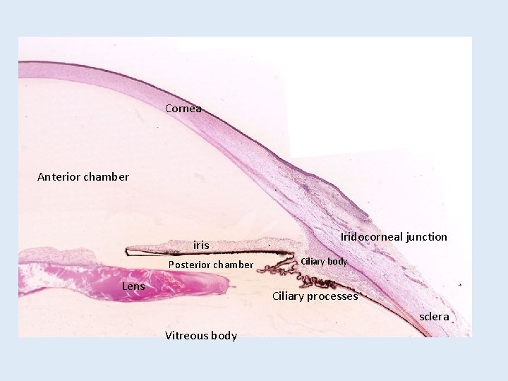 Cornea Anterior chamber iris Posterior chamber Lens Iridocorneal junction Ciliary body Ciliary processes sclera Cornea Anterior chamber iris Posterior chamber Lens Iridocorneal junction Ciliary body Ciliary processes sclera