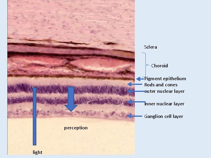 Sclera Choroid Pigment epithelium Rods and cones outer nuclear layer Inner nuclear layer Ganglion Sclera Choroid Pigment epithelium Rods and cones outer nuclear layer Inner nuclear layer Ganglion