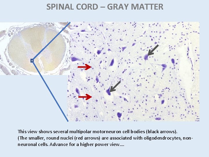 SPINAL CORD – GRAY MATTER This view shows several multipolar motorneuron cell bodies (black SPINAL CORD – GRAY MATTER This view shows several multipolar motorneuron cell bodies (black