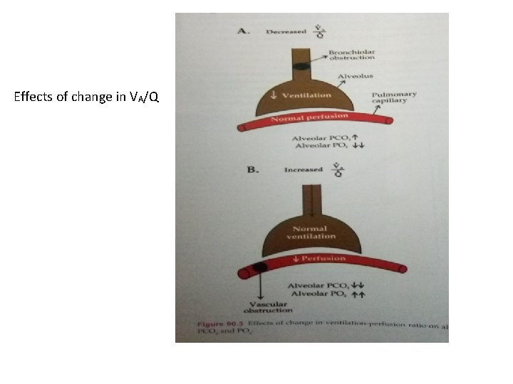 Effects of change in VA/Q 