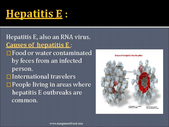 Hepatitis E : Hepatitis E, also an RNA virus. Causes of hepatitis E :