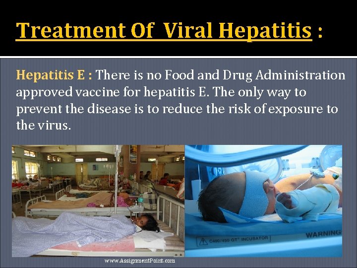 Treatment Of Viral Hepatitis : Hepatitis E : There is no Food and Drug