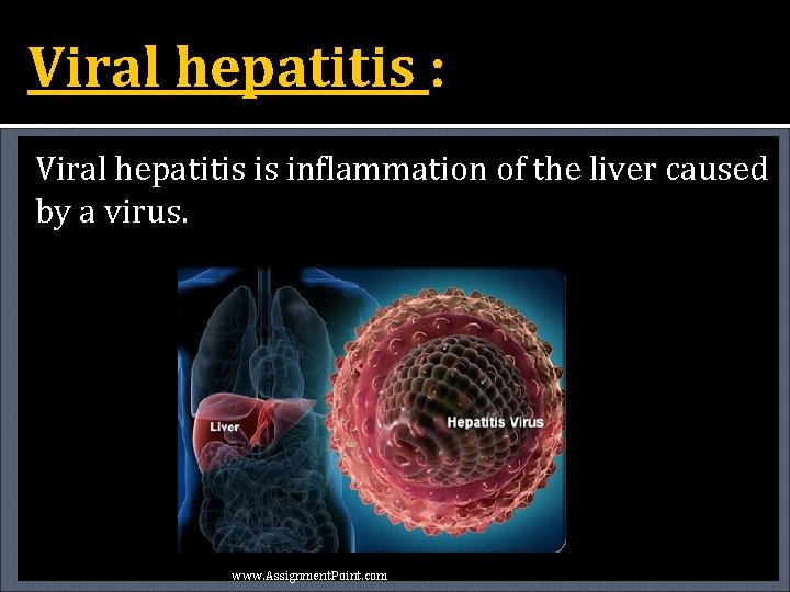 Viral hepatitis : Viral hepatitis is inflammation of the liver caused by a virus.