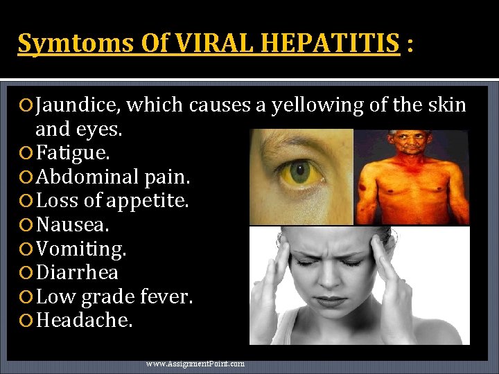 Symtoms Of VIRAL HEPATITIS : Jaundice, which causes a yellowing of the skin and