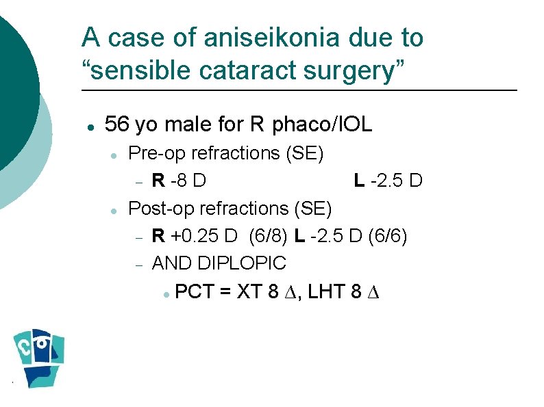 A case of aniseikonia due to “sensible cataract surgery” 56 yo male for R A case of aniseikonia due to “sensible cataract surgery” 56 yo male for R