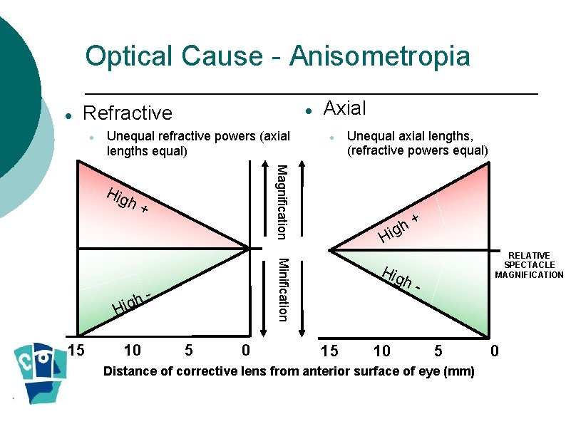 Optical Cause - Anisometropia Refractive Unequal refractive powers (axial lengths equal) Hig 5 0 Optical Cause - Anisometropia Refractive Unequal refractive powers (axial lengths equal) Hig 5 0