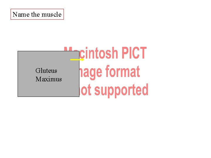 Name the muscle Gluteus ? Maximus Name the muscle Gluteus ? Maximus