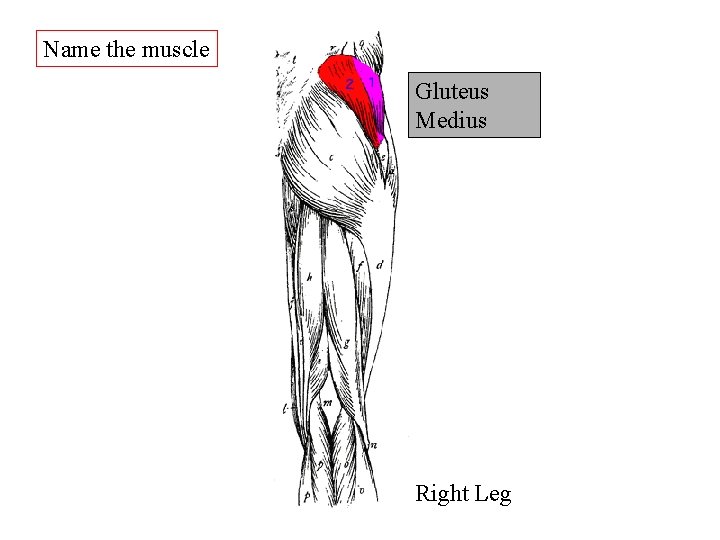 Name the muscle Gluteus Medius Right Leg Name the muscle Gluteus Medius Right Leg