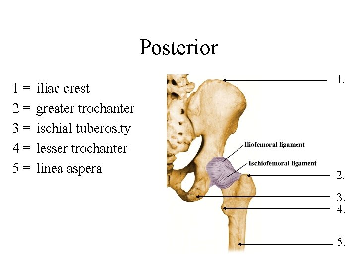 Posterior 1= 2= 3= 4= 5= iliac crest greater trochanter ischial tuberosity lesser trochanter Posterior 1= 2= 3= 4= 5= iliac crest greater trochanter ischial tuberosity lesser trochanter