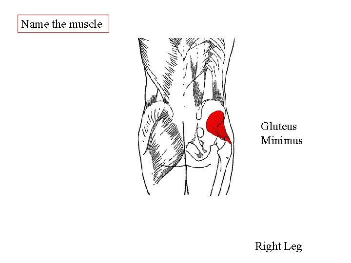 Name the muscle Gluteus Minimus Right Leg Name the muscle Gluteus Minimus Right Leg