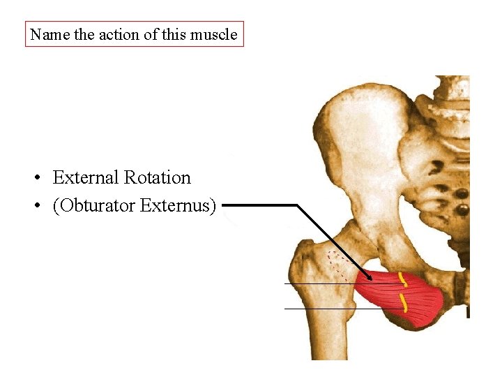 Name the action of this muscle • External Rotation • (Obturator Externus) Name the action of this muscle • External Rotation • (Obturator Externus)