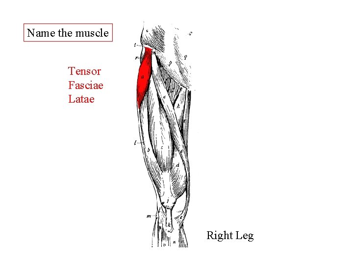 Name the muscle Tensor Fasciae Latae Right Leg Name the muscle Tensor Fasciae Latae Right Leg