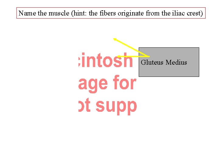 Name the muscle (hint: the fibers originate from the iliac crest) Gluteus Medius Name the muscle (hint: the fibers originate from the iliac crest) Gluteus Medius