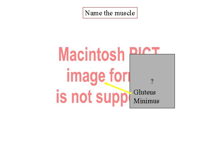 Name the muscle ? Gluteus Minimus Name the muscle ? Gluteus Minimus