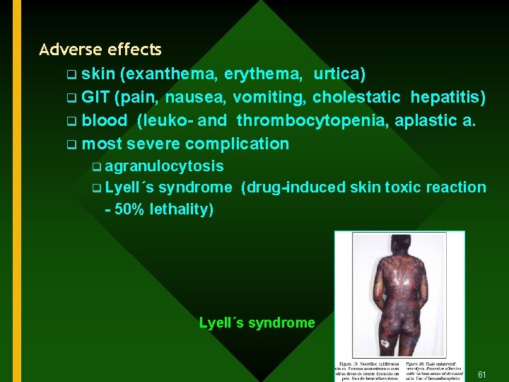 Adverse effects q skin (exanthema, erythema, urtica) q GIT (pain, nausea, vomiting, cholestatic hepatitis)