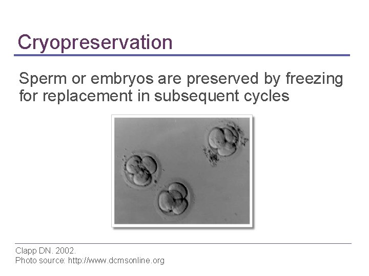 Cryopreservation Sperm or embryos are preserved by freezing for replacement in subsequent cycles Clapp