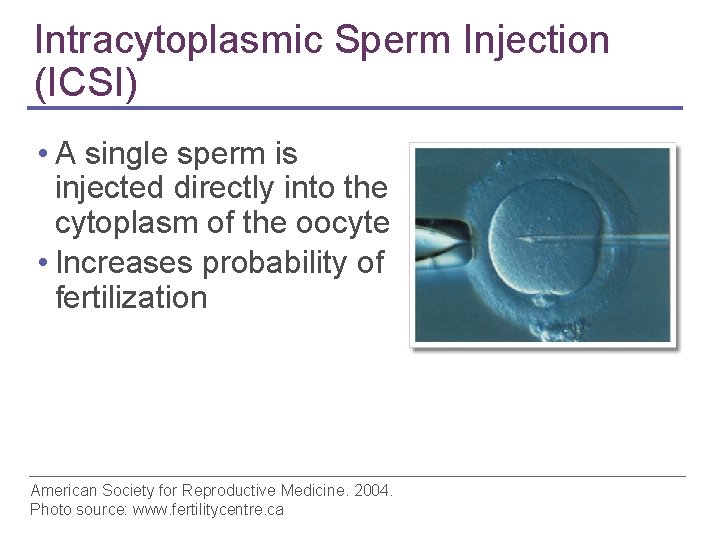 Intracytoplasmic Sperm Injection (ICSI) • A single sperm is injected directly into the cytoplasm