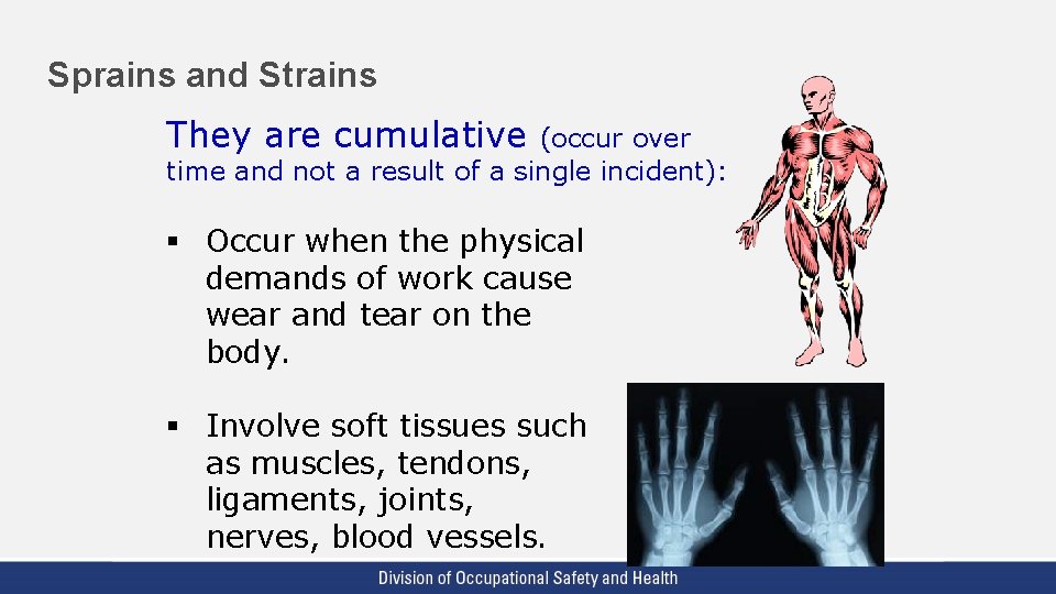 Sprains and Strains They are cumulative (occur over time and not a result of Sprains and Strains They are cumulative (occur over time and not a result of