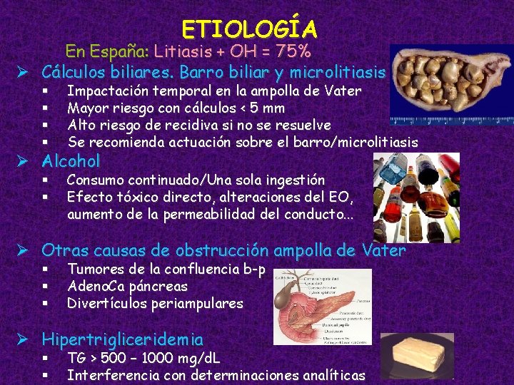 ETIOLOGÍA En España: Litiasis + OH = 75% Ø Cálculos biliares. Barro biliar y