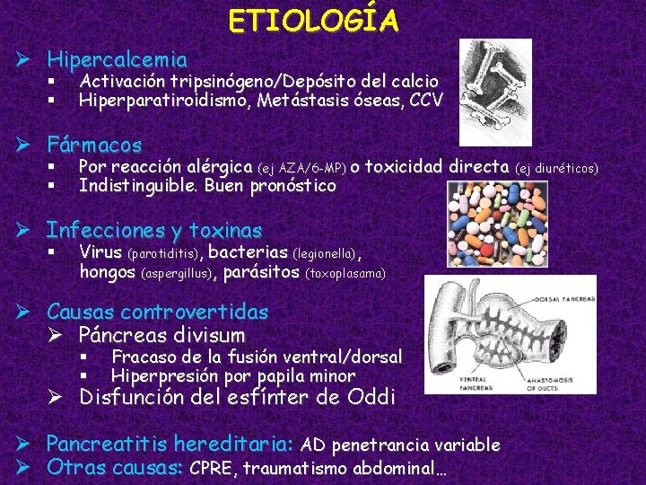 ETIOLOGÍA Ø Hipercalcemia § § Activación tripsinógeno/Depósito del calcio Hiperparatiroidismo, Metástasis óseas, CCV Ø