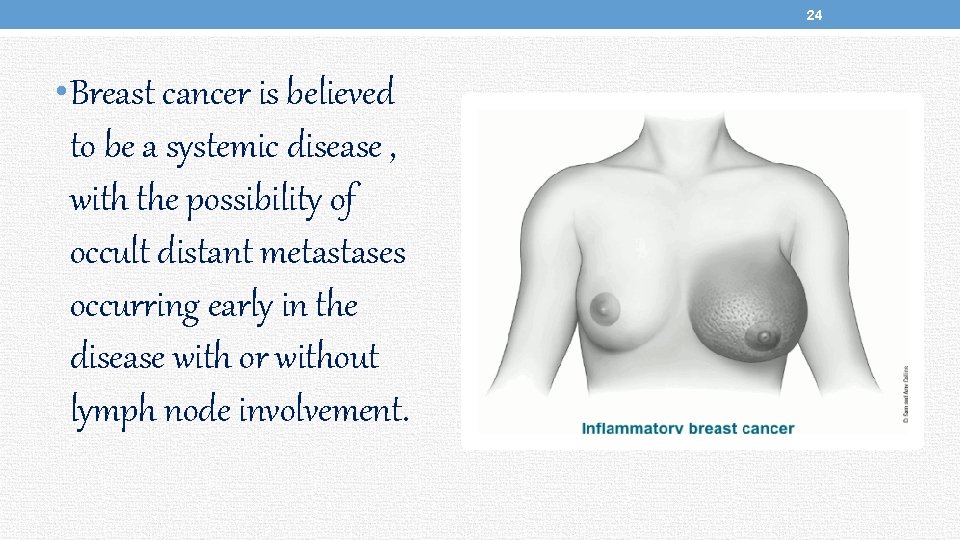 24 • Breast cancer is believed to be a systemic disease , with the