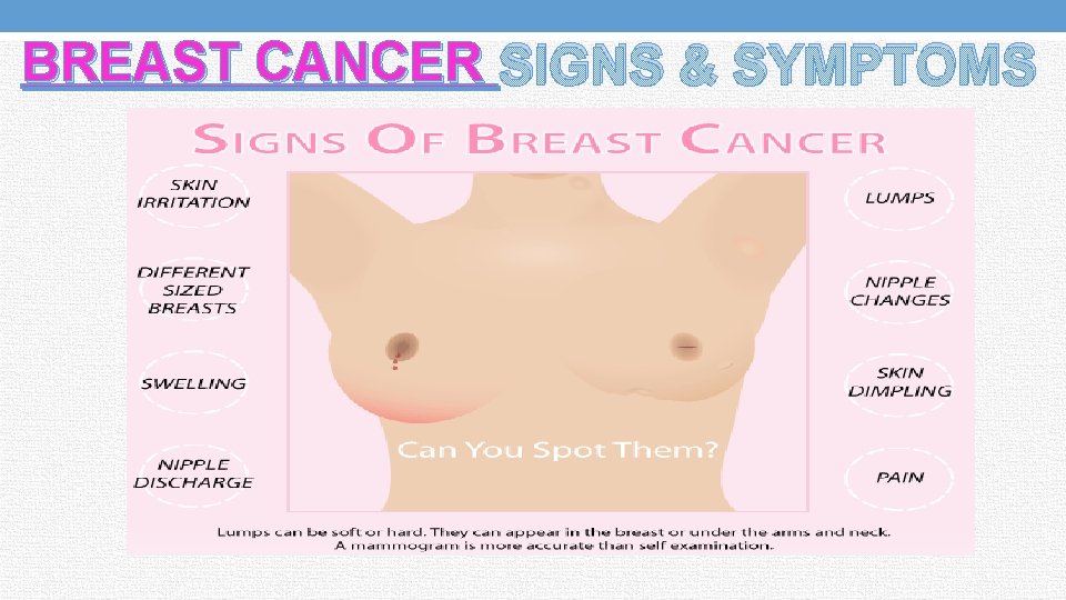 BREAST CANCER SIGNS & SYMPTOMS 