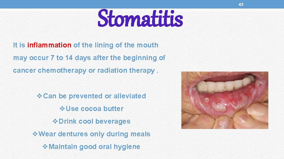 Stomatitis It is inflammation of the lining of the mouth may occur 7 to