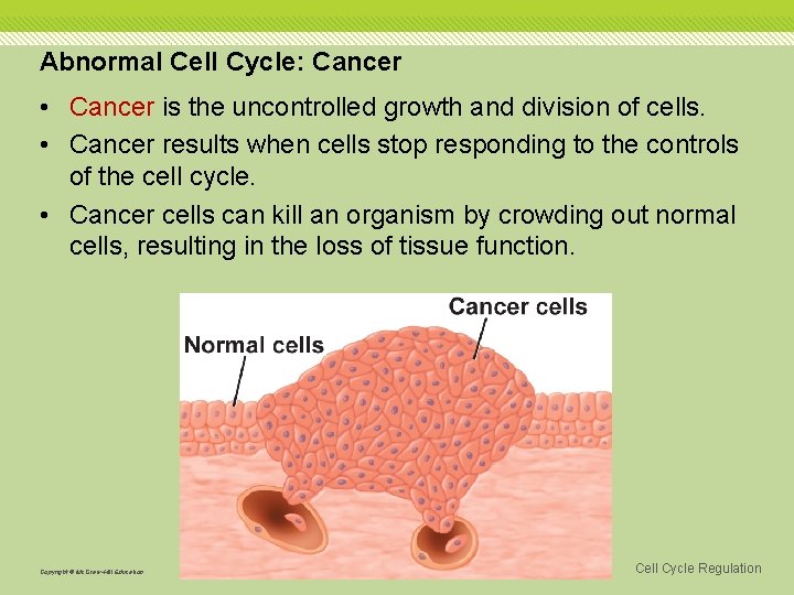Abnormal Cell Cycle: Cancer • Cancer is the uncontrolled growth and division of cells.