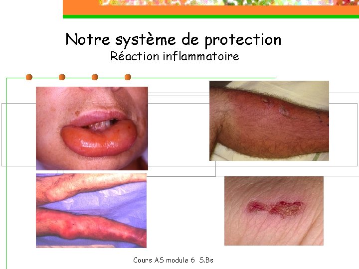 Notre système de protection Réaction inflammatoire Cours AS module 6 S. Bs 