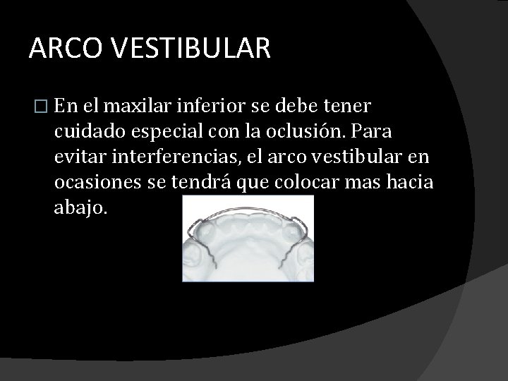 ARCO VESTIBULAR � En el maxilar inferior se debe tener cuidado especial con la ARCO VESTIBULAR � En el maxilar inferior se debe tener cuidado especial con la