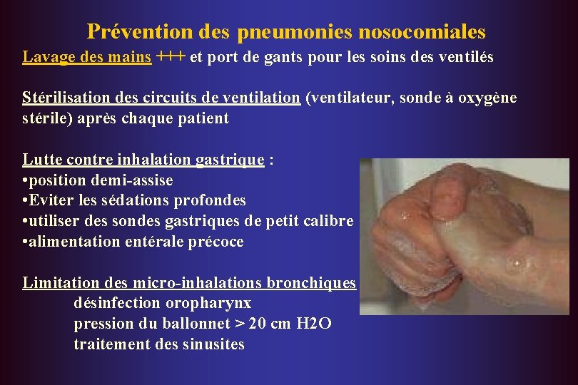 Prévention des pneumonies nosocomiales Lavage des mains +++ et port de gants pour les
