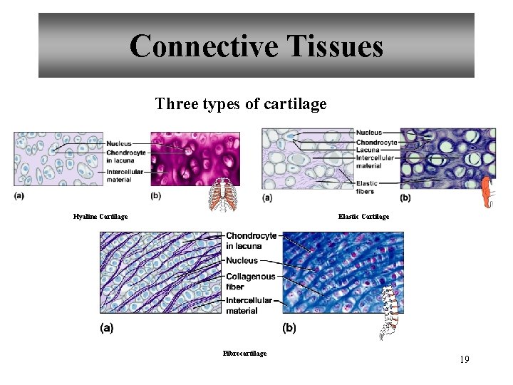 Connective Tissues Three types of cartilage Hyaline Cartilage Elastic Cartilage Fibrocartilage 19 