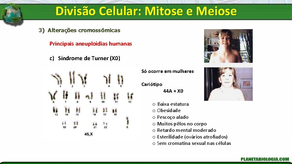 Divisão Celular: Mitose e Meiose 3) Alterações cromossômicas Principais aneuploidias humanas c) Síndrome de