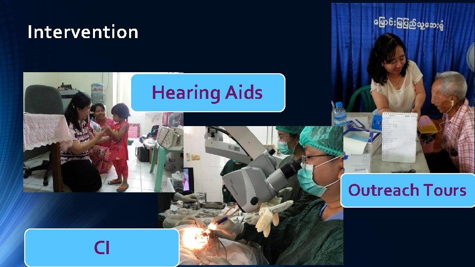 Intervention Hearing Aids Outreach Tours CI 