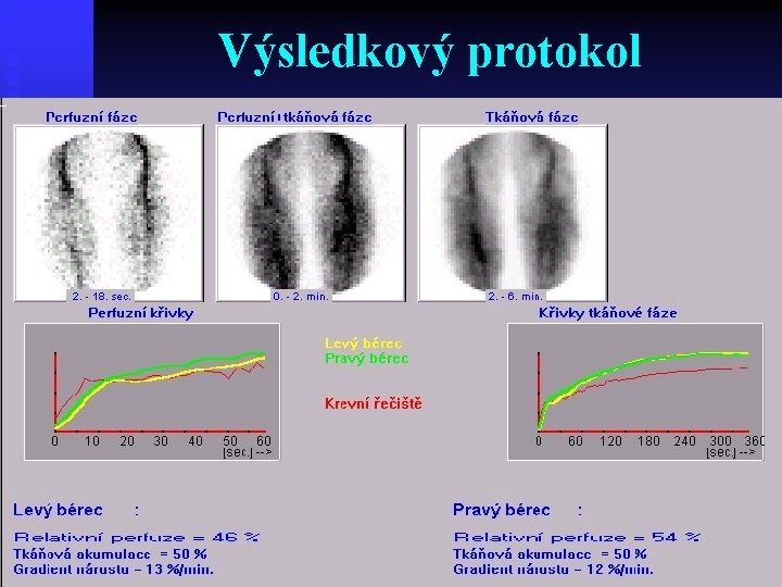 Výsledkový protokol Výsledkový protokol