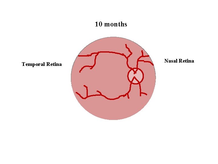 10 months Temporal Retina Nasal Retina 