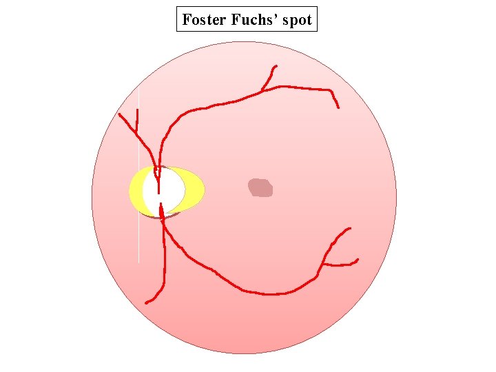 Foster Fuchs’ spot 