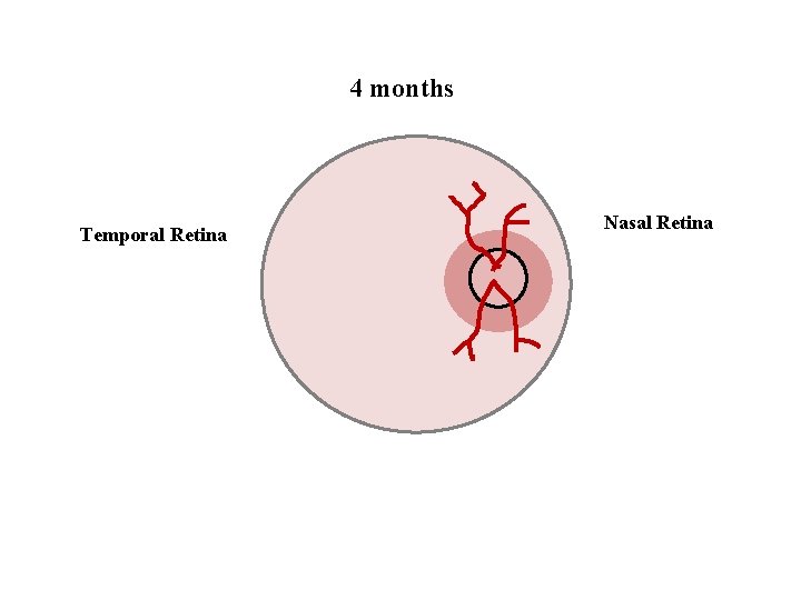 4 months Temporal Retina Nasal Retina 