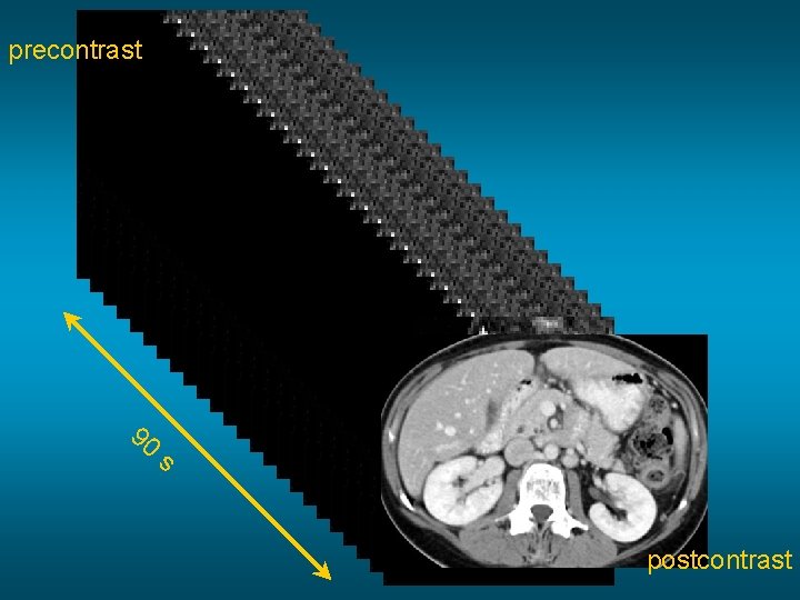 precontrast 90 s postcontrast 