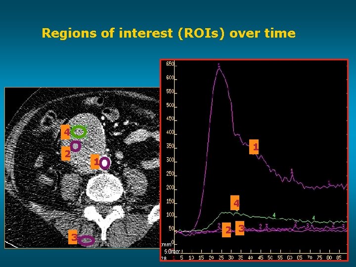 Regions of interest (ROIs) over time 4 1 2 1 4 3 2 3
