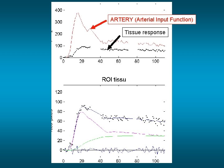 ARTERY (Arterial Input Function) Tissue response 
