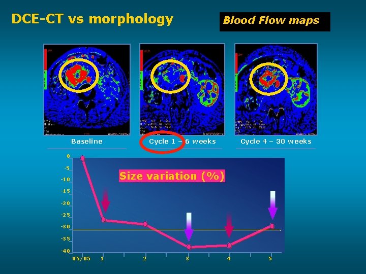 DCE-CT vs morphology Baseline Blood Flow maps Cycle 1 – 6 weeks Cycle 4