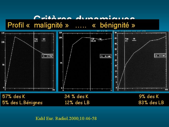 Critères dynamiques Profil « malignité » …. . « bénignité » Kuhl Eur. Radiol.
