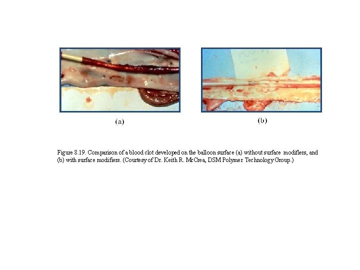 Figure 8. 19. Comparison of a blood clot developed on the balloon surface (a)